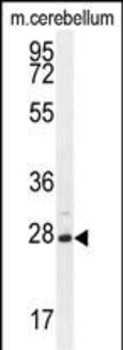 Invitrogen VSTM2A Polyclonal Antibody 400 &mu;L; Unconjugated:Antibodies,