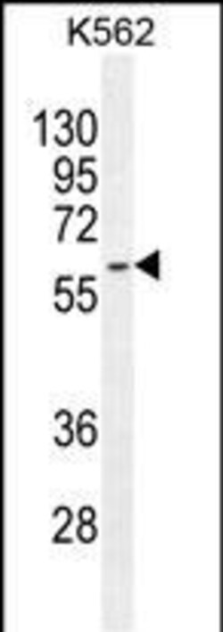 Invitrogen KRT73 Polyclonal Antibody 400 &mu;L; Unconjugated:Antibodies,