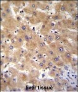 Invitrogen GAGE12B Polyclonal Antibody 400 &mu;L; Unconjugated:Antibodies,