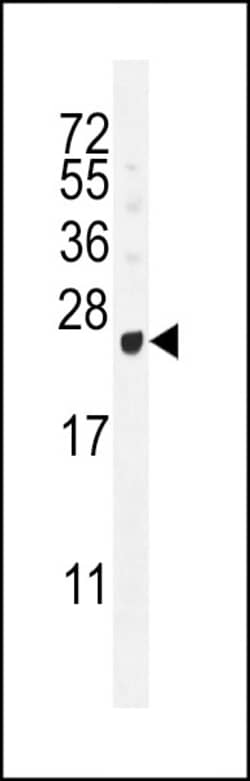 Invitrogen GAGE12B Polyclonal Antibody 400 &mu;L; Unconjugated:Antibodies,