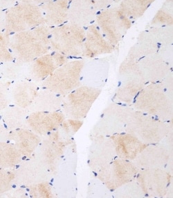 Invitrogen CLEC4F Polyclonal Antibody 400 &mu;L; Unconjugated:Antibodies,