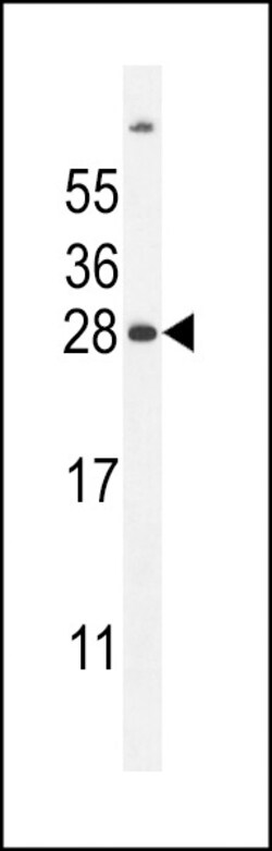 Invitrogen UBD Polyclonal Antibody 400 &mu;L; Unconjugated:Antibodies,