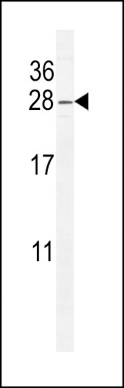 Invitrogen ARL5B Polyclonal Antibody 400 &mu;L; Unconjugated:Antibodies,