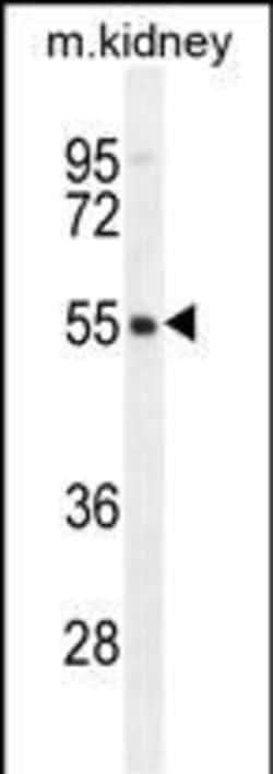 Invitrogen FBXO47 Polyclonal Antibody 400 &mu;L; Unconjugated:Antibodies,