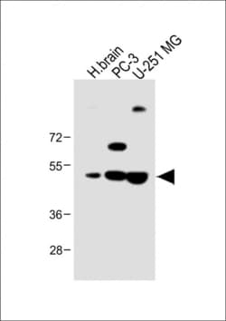 Invitrogen AP1M1 Polyclonal Antibody 400 &mu;L; Unconjugated:Antibodies,