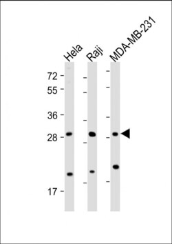 Invitrogen RAB12 Polyclonal Antibody 400 &mu;L | Buy Online | Invitrogen&trade; | Fisher Scientific