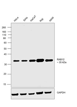 Invitrogen RAB12 Polyclonal Antibody 400 &mu;L | Buy Online | Invitrogen&trade; | Fisher Scientific