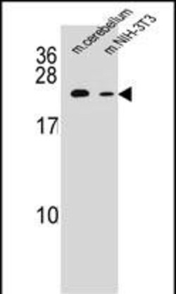 Invitrogen RAB12 Polyclonal Antibody 400 &mu;L | Buy Online | Invitrogen&trade; | Fisher Scientific