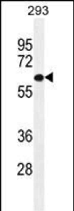 Invitrogen PATL2 Polyclonal Antibody 400 &mu;L; Unconjugated:Antibodies,