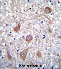 Invitrogen PTCHD1 Polyclonal Antibody 400 &mu;L; Unconjugated:Antibodies,