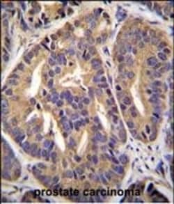 Invitrogen GTF2H2C Polyclonal Antibody 400 &mu;L; Unconjugated:Antibodies,