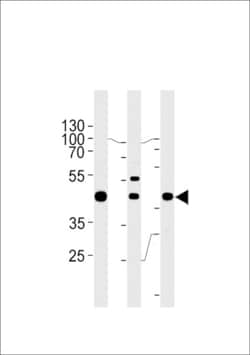 Invitrogen GTF2H2C Polyclonal Antibody 400 &mu;L; Unconjugated:Antibodies,