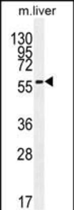 Invitrogen DHCR7 Polyclonal Antibody 400 &mu;L | Buy Online | Invitrogen&trade; | Fisher Scientific