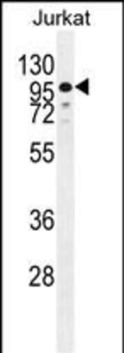 Invitrogen ZNF841 Polyclonal Antibody 400 &mu;L; Unconjugated:Antibodies,