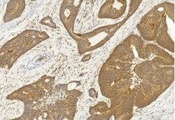 Invitrogen SASH1 Polyclonal Antibody 400 &mu;L; Unconjugated:Antibodies,