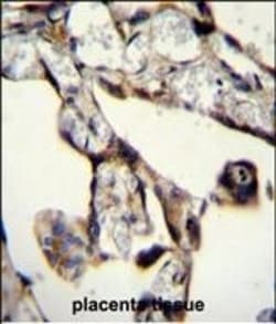 Invitrogen SASH1 Polyclonal Antibody 400 &mu;L; Unconjugated:Antibodies,