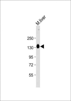 Invitrogen SASH1 Polyclonal Antibody 400 &mu;L; Unconjugated:Antibodies,