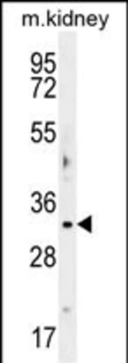 Invitrogen OBFC2B Polyclonal Antibody 400 &mu;L | Buy Online | Invitrogen&trade; | Fisher Scientific