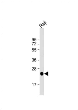Invitrogen UQCRFS1 Polyclonal Antibody 400 &mu;L; Unconjugated:Antibodies,