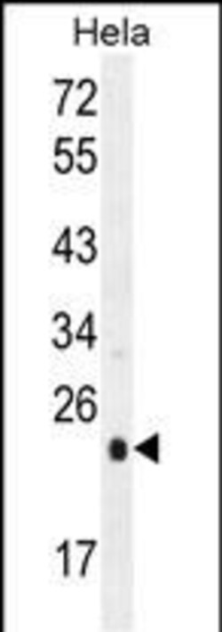 Invitrogen UQCRFS1 Polyclonal Antibody 400 &mu;L; Unconjugated:Antibodies,