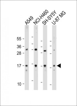 Invitrogen TMEM100 Polyclonal Antibody 400 &mu;L; Unconjugated:Antibodies,