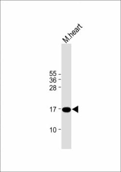 Invitrogen IEX-1 Polyclonal Antibody 400 &mu;L; Unconjugated:Antibodies,