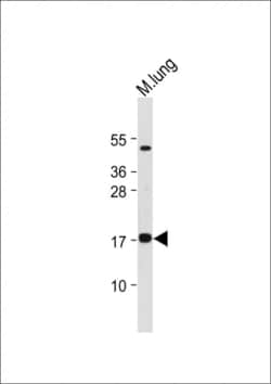 Invitrogen IEX-1 Polyclonal Antibody 400 &mu;L; Unconjugated:Antibodies,