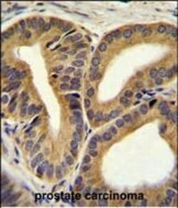 Invitrogen TRIM65 Polyclonal Antibody 400 &mu;L; Unconjugated:Antibodies,