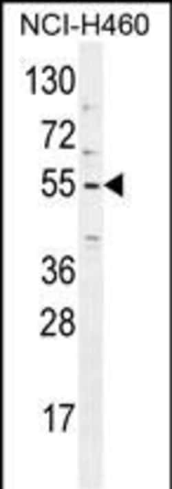 Invitrogen TRIM65 Polyclonal Antibody 400 &mu;L; Unconjugated:Antibodies,