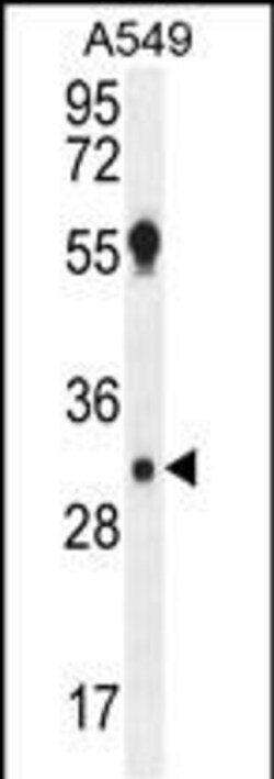 Invitrogen AQP12B Polyclonal Antibody 400 &mu;L | Buy Online | Invitrogen&trade; | Fisher Scientific