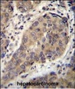 Invitrogen WTIP Polyclonal Antibody 400 &mu;L; Unconjugated:Antibodies,
