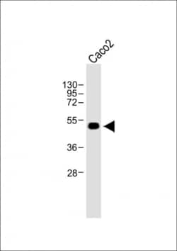 Invitrogen WTIP Polyclonal Antibody 400 &mu;L; Unconjugated:Antibodies,