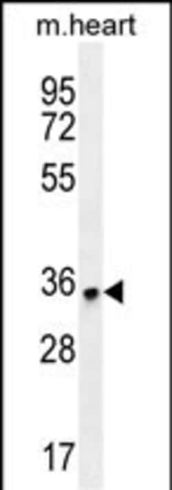 Invitrogen ZNF524 Polyclonal Antibody 400 &mu;L; Unconjugated:Antibodies,