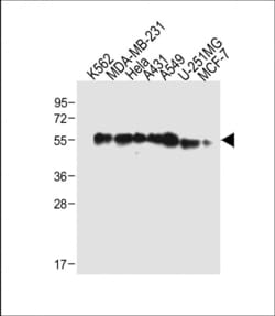 Invitrogen TUBB6 Polyclonal Antibody 400 &mu;L; Unconjugated:Antibodies,
