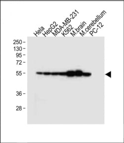 Invitrogen TUBB2B Polyclonal Antibody 400 &mu;L | Buy Online | Invitrogen&trade; | Fisher Scientific