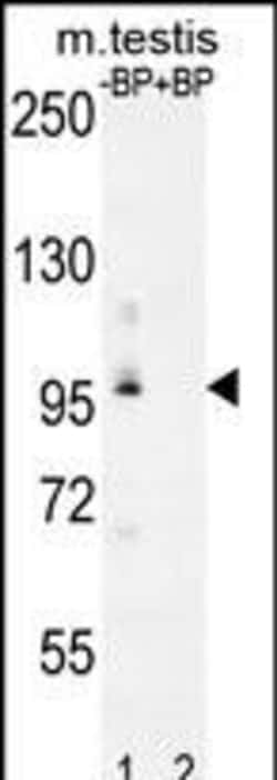 Invitrogen PDPR Polyclonal Antibody 400 &mu;L; Unconjugated:Antibodies,