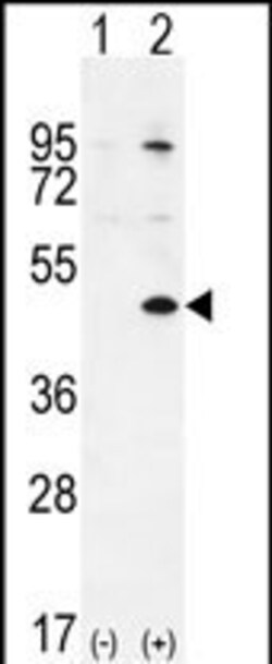 Invitrogen TGIF Polyclonal Antibody 400 &mu;L; Unconjugated:Antibodies,