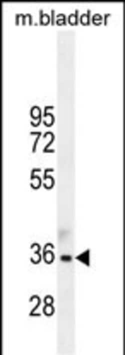 Invitrogen TGIF Polyclonal Antibody 400 &mu;L; Unconjugated:Antibodies,