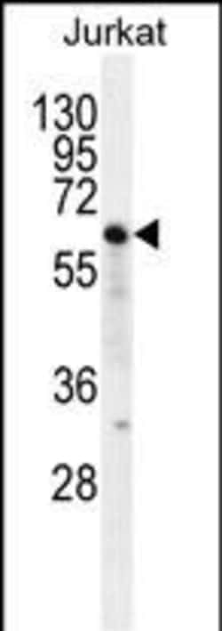 Invitrogen Naked2 Polyclonal Antibody 400 &mu;L | Buy Online | Invitrogen&trade; | Fisher Scientific