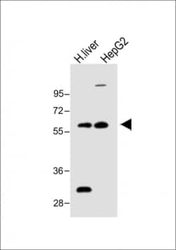 Invitrogen FADS2 Polyclonal Antibody 200 &mu;L; Unconjugated:Antibodies,