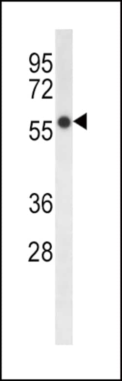 Invitrogen FADS2 Polyclonal Antibody 200 &mu;L; Unconjugated:Antibodies,
