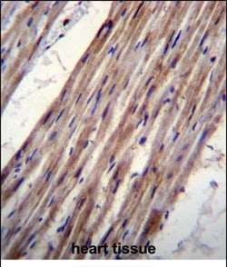 Invitrogen Kir6.1 (KCNJ8) Polyclonal Antibody 400 &mu;L | Buy Online | Invitrogen&trade; | Fisher Scientific