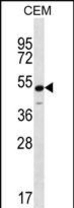 Invitrogen Kir6.1 (KCNJ8) Polyclonal Antibody 400 &mu;L | Buy Online | Invitrogen&trade; | Fisher Scientific