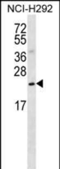 Invitrogen SLMO2 Polyclonal Antibody 400 &mu;L; Unconjugated:Antibodies,