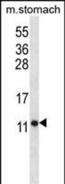 Invitrogen ATP5J Polyclonal Antibody 400 &mu;L | Buy Online | Invitrogen&trade; | Fisher Scientific