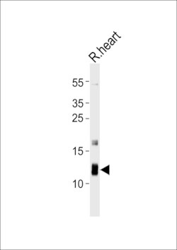 Invitrogen ATP5J Polyclonal Antibody 400 &mu;L | Buy Online | Invitrogen&trade; | Fisher Scientific