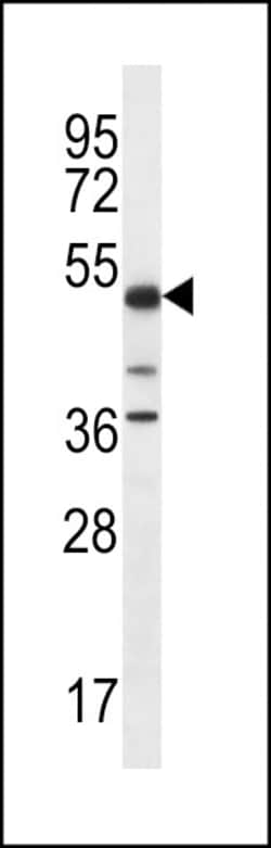 Invitrogen PSTPIP1 Polyclonal Antibody 400 &mu;L; Unconjugated:Antibodies,