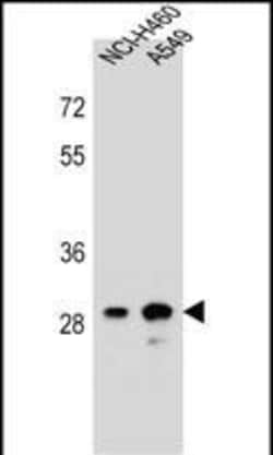 DHRS4L1 Polyclonal Antibody:Antibodies, Polyclonal