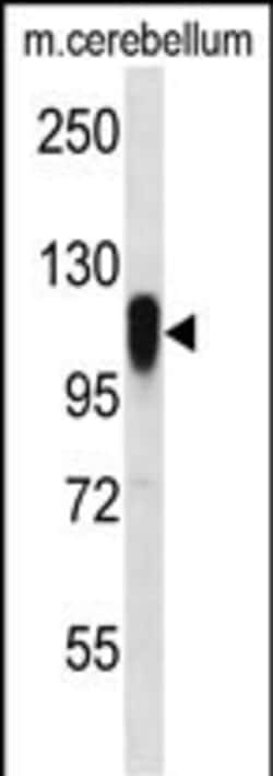 Invitrogen FBXO41 Polyclonal Antibody 400 &mu;L; Unconjugated:Antibodies,