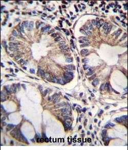 Invitrogen ME2 Polyclonal Antibody 400 &mu;L; Unconjugated:Antibodies,